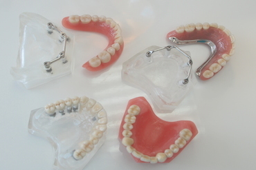 ALL TYPES OF DENTURES